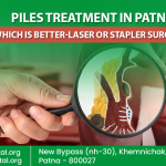 Piles Treatment